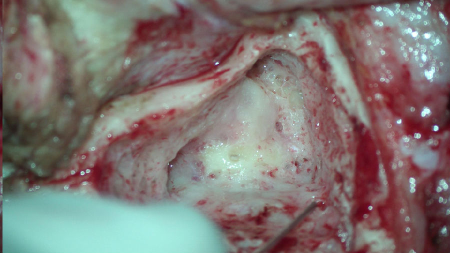 ��Ժ�ɹ��_(k��i)չ������Ҏ(gu��)��˨���g(sh��)